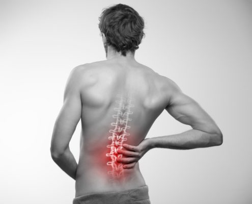 Causes of lumbar radiculopathy