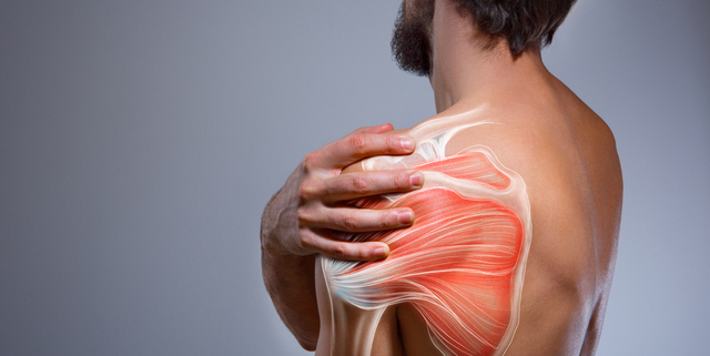 Rotator cuff injury